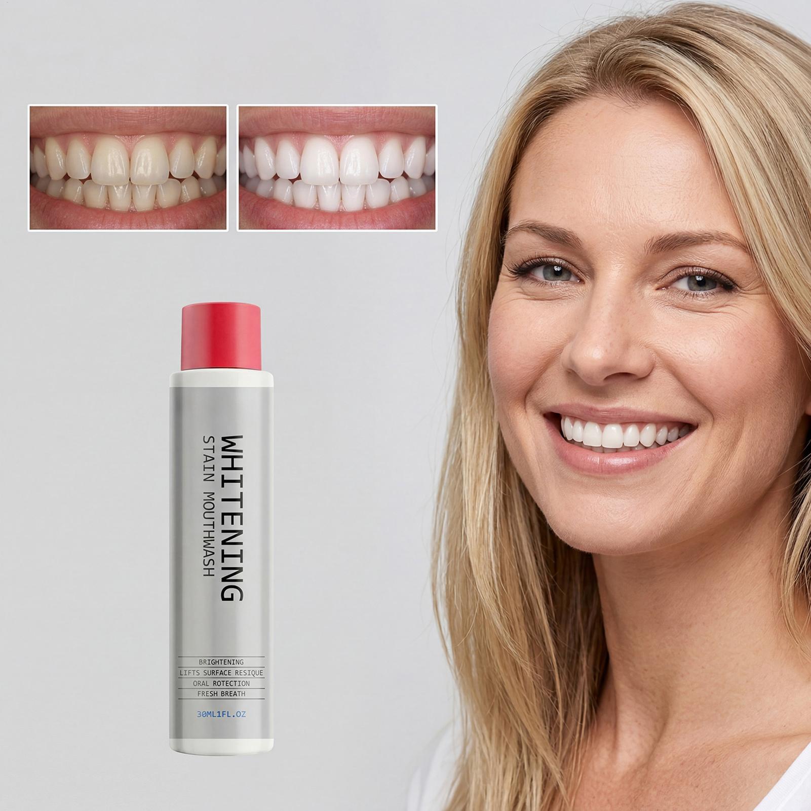 30ml Aufhellendes Mundwasser e – Teeth Whitening Mouthwash Bewertung und Preis